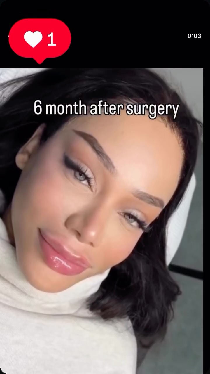 Lumora Surgery video 11 från Istanbul